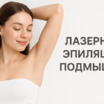 Лазерная эпиляция подмышек