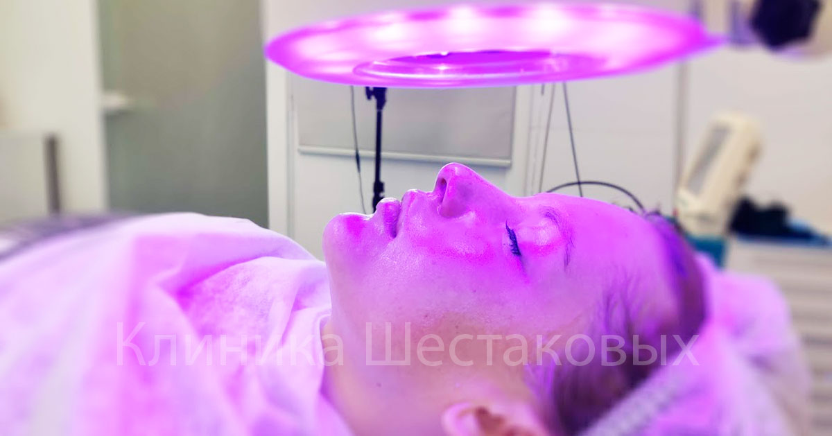 Как вылечить розацеа отзывы