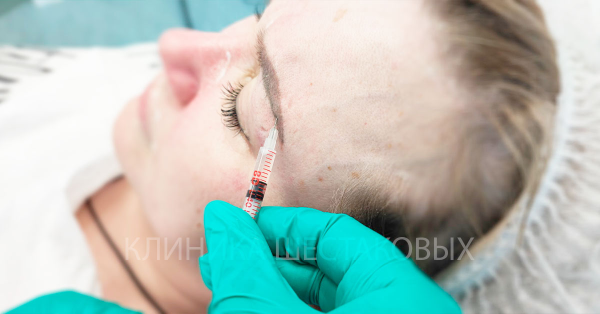 Стоит ли колоть ботокс
