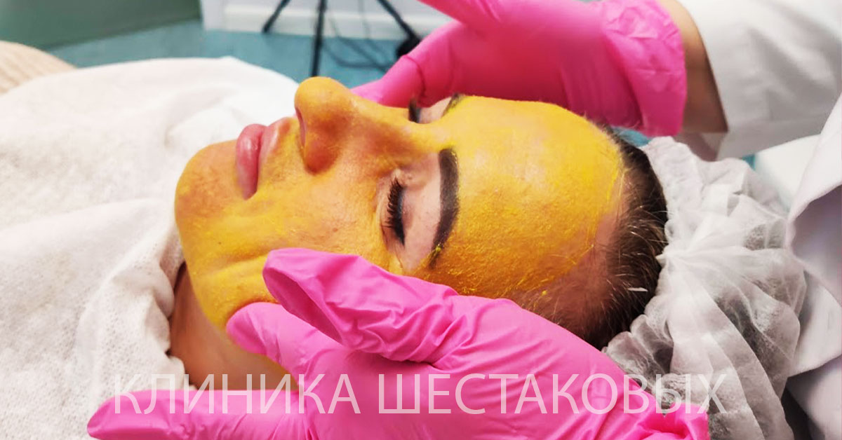 Пилинг в феврале