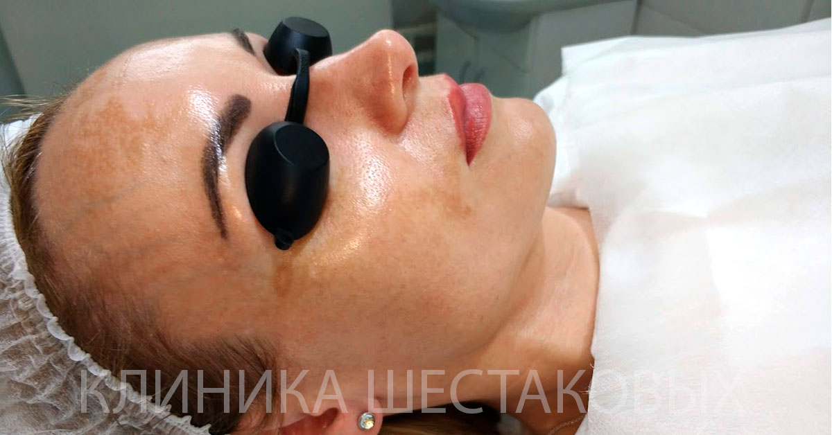 Убрать пигментацию