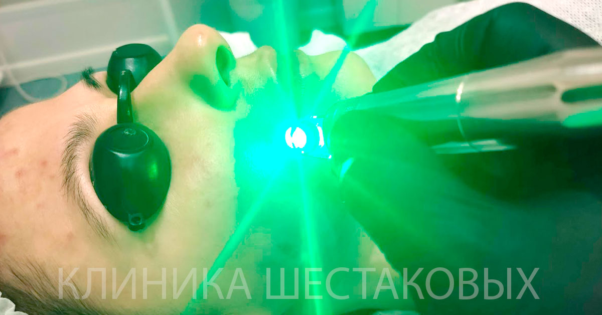 Убрать пигментацию