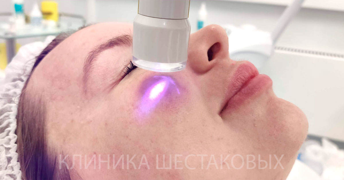 Лазерная биоревитализация