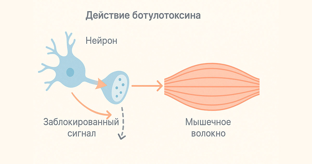 Когда начинает действовать ботокс