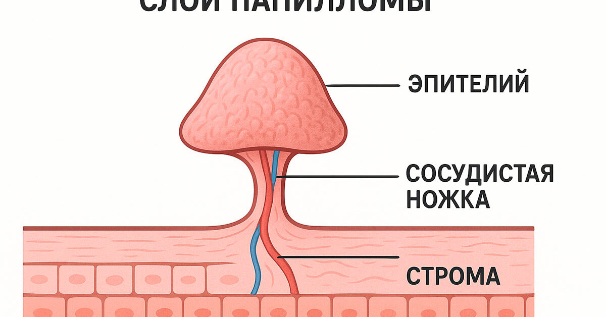 Папиллома строение