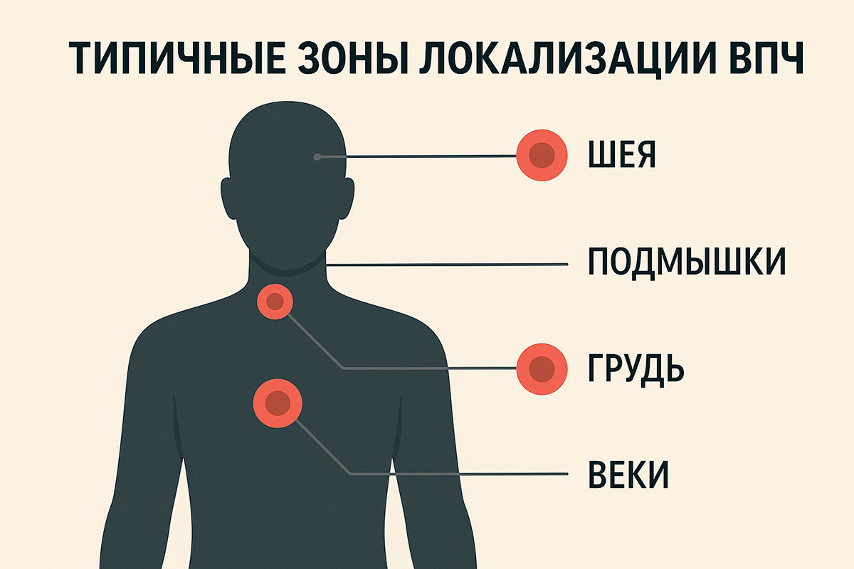 Папилломы на шее