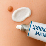 Цинковая мазь от папиллом
