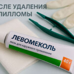 Левомеколь от папиллом