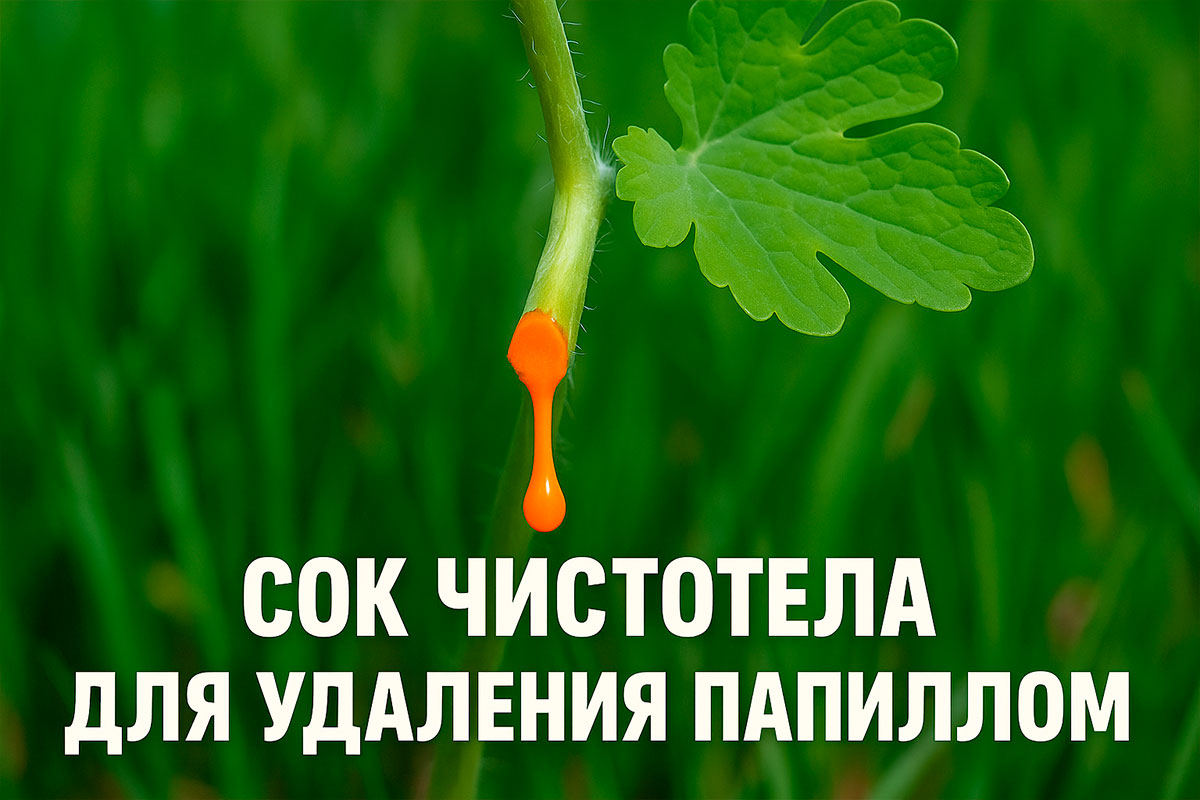 Можно ли прижигать папилломы чистотелом