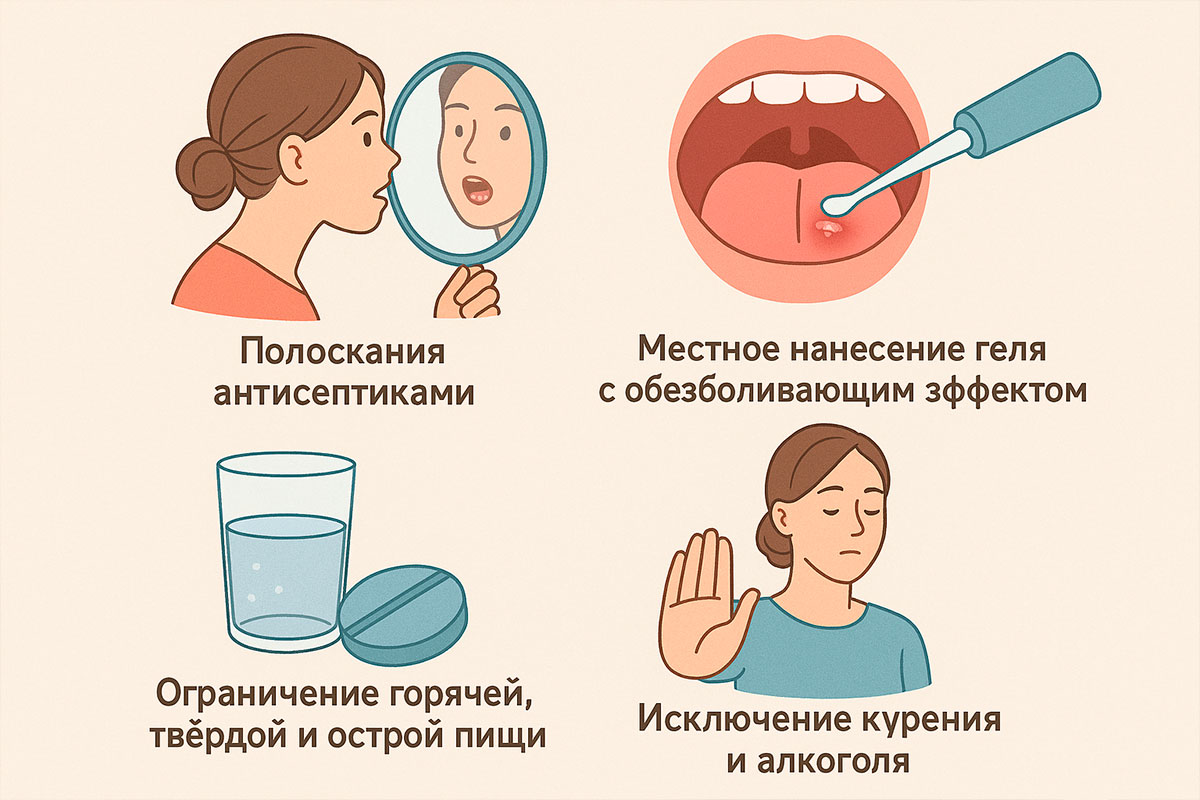 Уход после удаления папиллом на слизистой