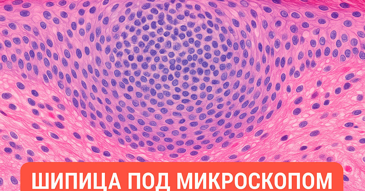 Шипица под микроскопом