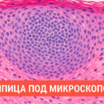 Шипица под микроскопом