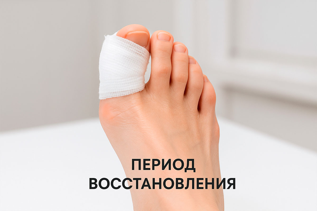 Шпора на пальце ноги