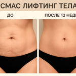 Смас лифтинг тела