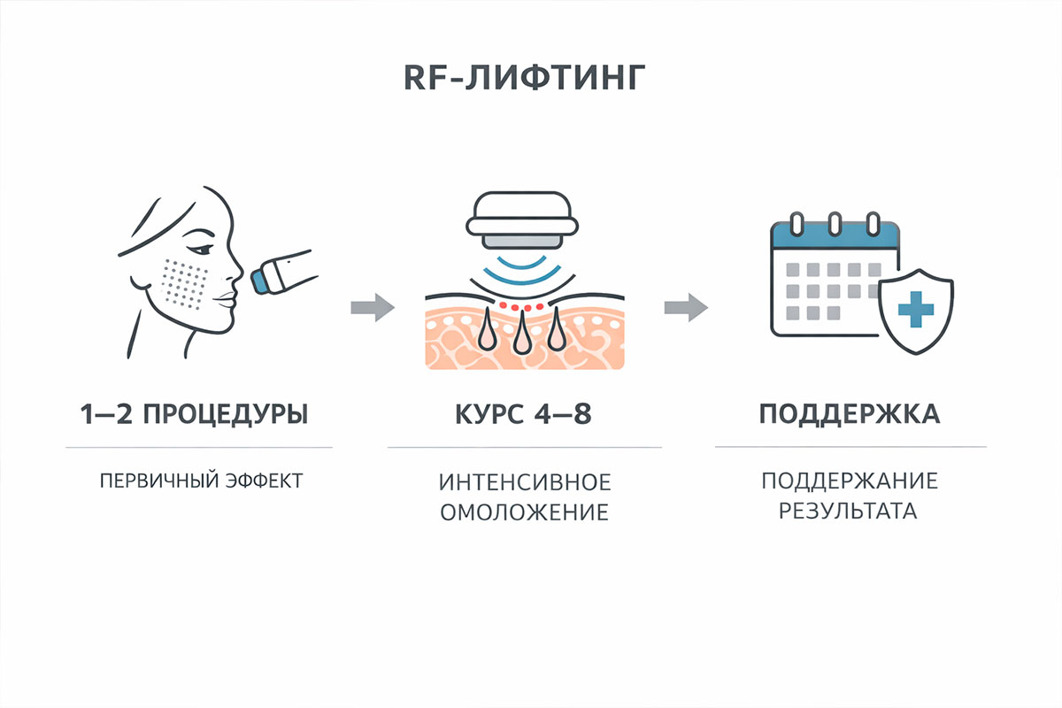 Схема курса RF-лифтинга: первые сеансы, курс и поддержка