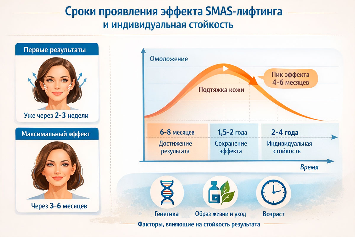 Инфографика сроков проявления эффекта SMAS-лифтинга и индивидуальной стойкости