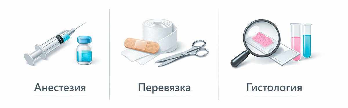 Дополнительные услуги при удалении новообразований: анестезия, перевязка, гистология