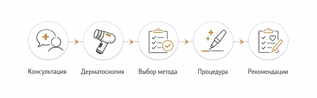 Пошаговая схема удаления папиллом: консультация, дерматоскопия, выбор метода, процедура, уход