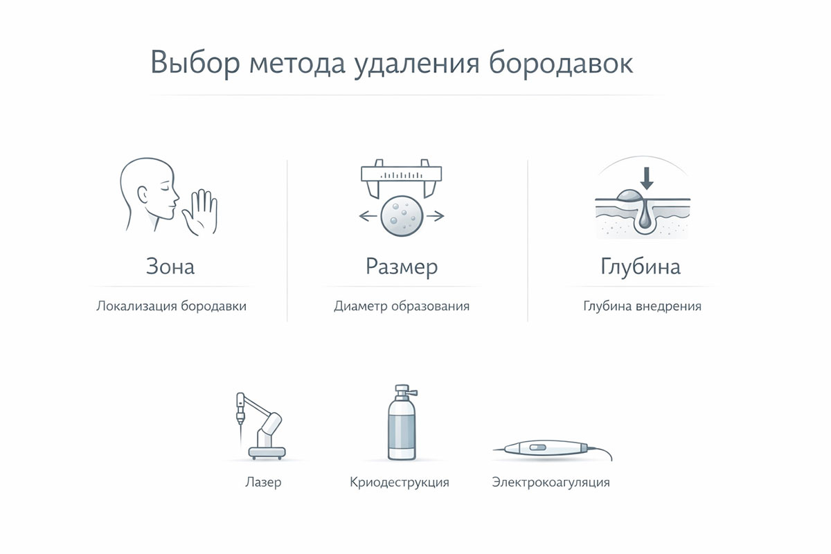 Инфографика выбора метода удаления бородавок по зоне, размеру и глубине