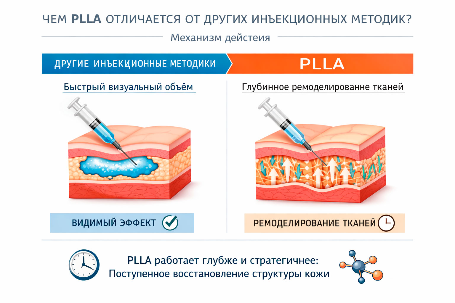 Отличия инъекций PLLA от других инъекционных методик в эстетической косметологии